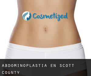 Abdominoplastia en Scott County