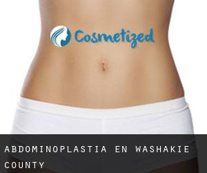 Abdominoplastia en Washakie County