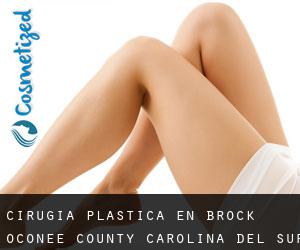 cirugía plástica en Brock (Oconee County, Carolina del Sur)