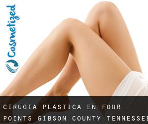 cirugía plástica en Four Points (Gibson County, Tennessee)