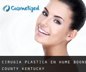 cirugía plástica en Hume (Boone County, Kentucky)