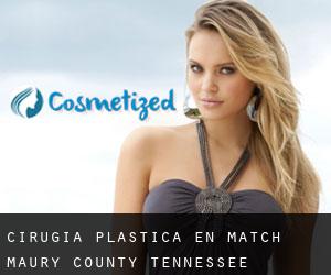 cirugía plástica en Match (Maury County, Tennessee)