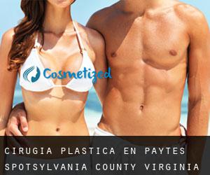 cirugía plástica en Paytes (Spotsylvania County, Virginia)