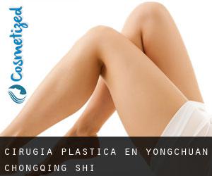 cirugía plástica en Yongchuan (Chongqing Shi)